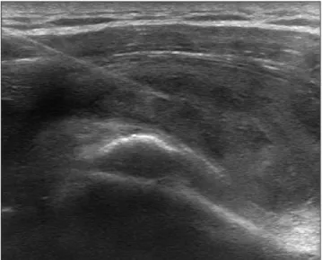 Table 1. Postoperative Follow-up Range of Motion and Functional Scores of the Patient’s Right Shoulder
