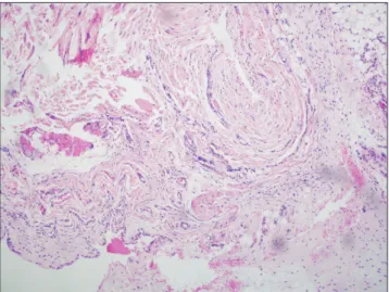 Fig. 2. Histopathologic section with normal cellularity and collagen orienta-