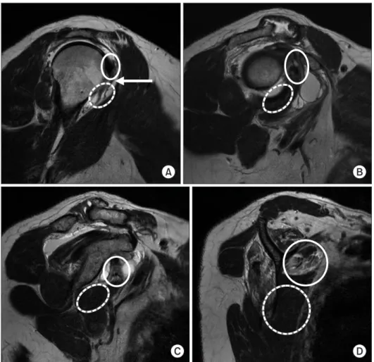 Fig. 1. (A–D) Images from the humerus to­