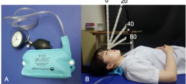 Fig.  1.  Pressure  biofeedback  unit(A)  and  CCF(B)   