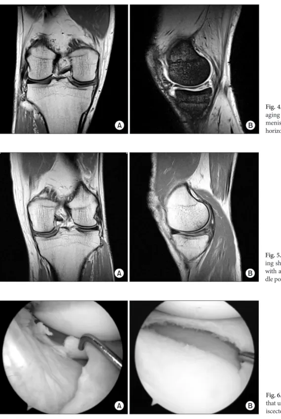 Fig. 4. Right knee magnetic resonance im­