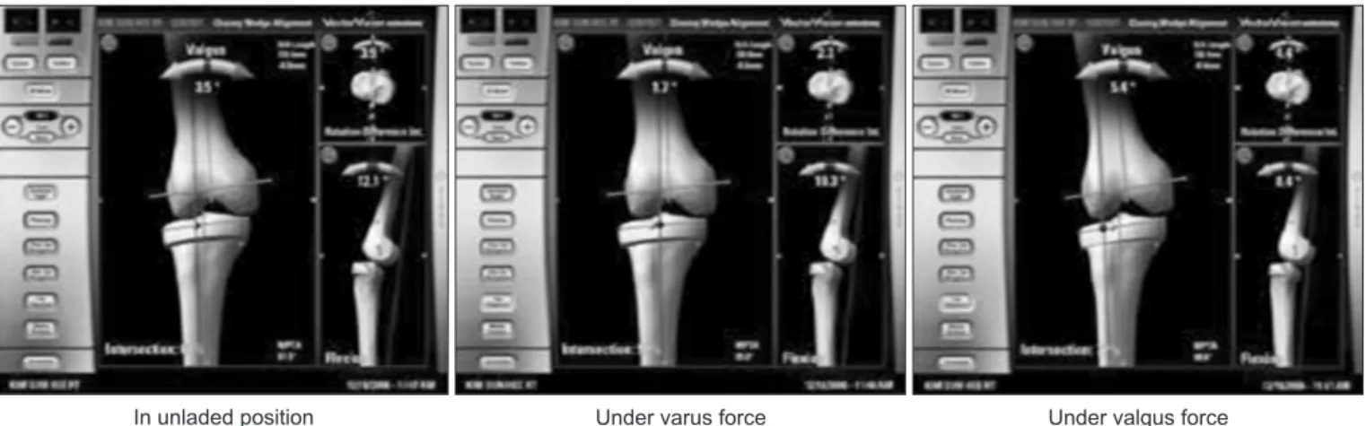 graphic measurements. The intra­ and inter­observer reliabilities  of all measurements were assessed using intraclass correlation  coefficients (ICC) 17) , which were >0.8 for all measures.