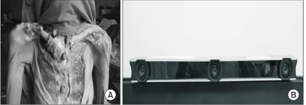 Fig. 2. Five reflective bony markers were  attached to the proximal and distal sternum  and clavicle to recognize the axis