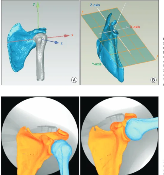 Fig. 3. Using computed tomography images,  3-dimensional (3D) models of the humerus,  scapula, and clavicle were constructed with  ITKSNAP (Penn Image Computing and  Sci-ence Laboratory, Philadelphia, PA, USA),  and anatomic coordination was assigned to  3