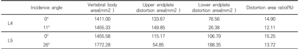 Table  4.  Comparison  of  distortion  area  according  to  incidence  angle  on  L4  and  L5 Incidence  angle Vertebral  body 