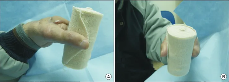 Table 1. Classification of multi-segment hand amputations 9