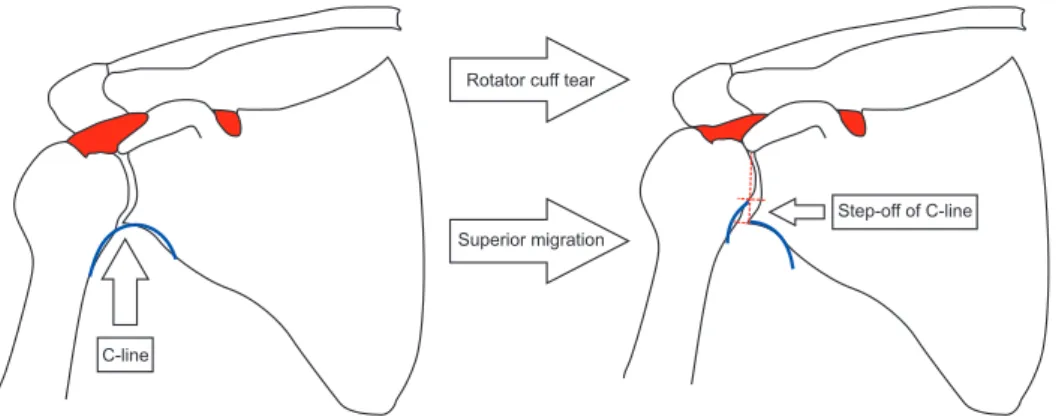 Fig. 2. Step-off of C-line. 