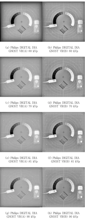 그림  3.  Philips  DIGITAL  DIAGNOST  VR(A)와  Philips  DIGITAL  DIAGNOST  VR(B)의  dynamic  step  wedge  영상 