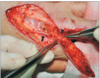 Fig. 4. Image obtained 3 months after the operation.