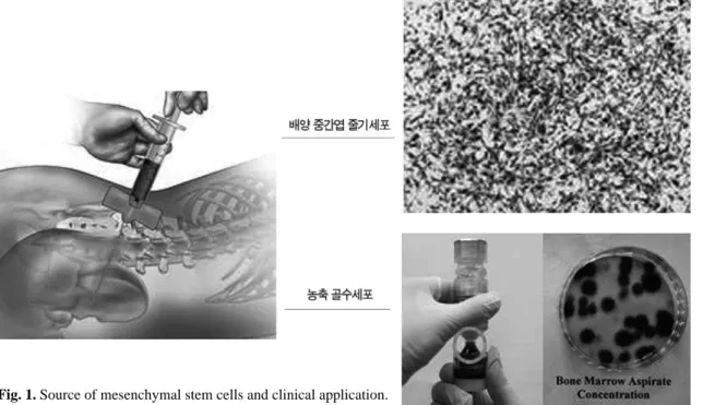 Fig. 1. Source of mesenchymal stem cells and clinical application. 