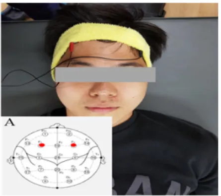 Fig.  1.  Application  of  tDCS  and  pad  attaching  area                   (A)  pad  attaching  area  F 3   and  F 4