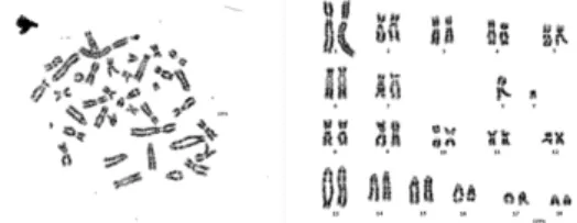 Fig. 6. Karyotype in somatic cells of transgenic piglet