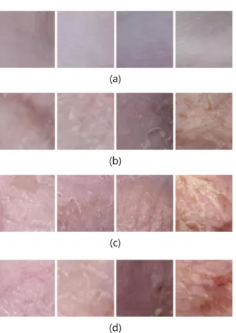 Fig. 3. Week 1, 3, 4, 5 atopic dermatitis image data used for PCA, (a) Normal group, (b) PEMF 15Hz group, (c) PEMF 75 Hz group, (d) Sham group