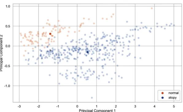 Fig. 5. PCA of data taken with SAK2L4 sensor camera, labeled by AD group or normal group