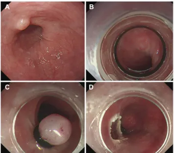 Fig. 2. Microscopic findings showing a mucoepidermoid carcinoma consisting of squamous cells, mucus-producing cells and  intermediate cells (A, B, H&amp;E, ×200; C, H&amp;E, ×400)