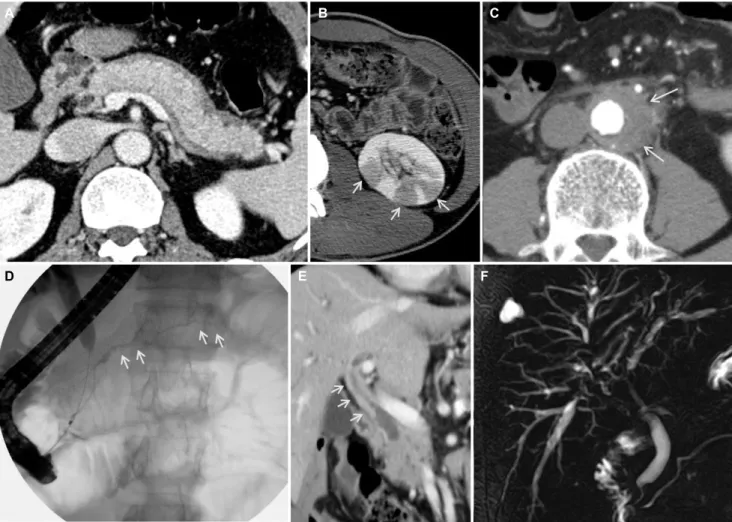 Fig. 1. Imaging features of autoimmune pancreatitis, immunoglobulin G4-related sclerosing cholangitis, and other organ involvement