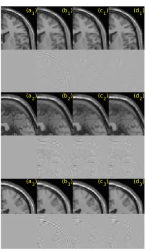 그림 7. T1-MRI 템플릿의 움직임 보정 결과: (a) 오리지날 이미지, 불규칙한 데이터를 이용한 (b) MLS 보간 결과, (c) DAMLS 결과, 그 리고 (d) FAMLS 결과 