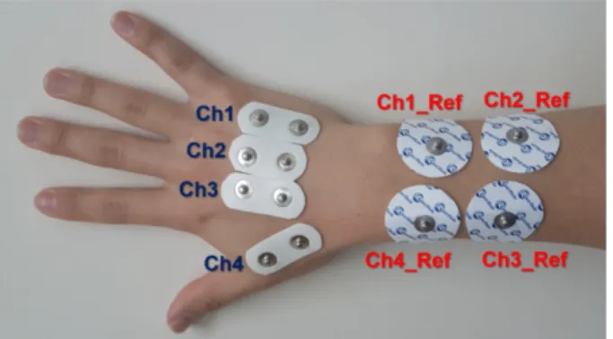 Fig. 1. Positions of four bipolar electrodes and their corresponding reference electrodes
