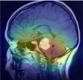 Fig.  8.  Accuracy  of  pretrained  CNN  models