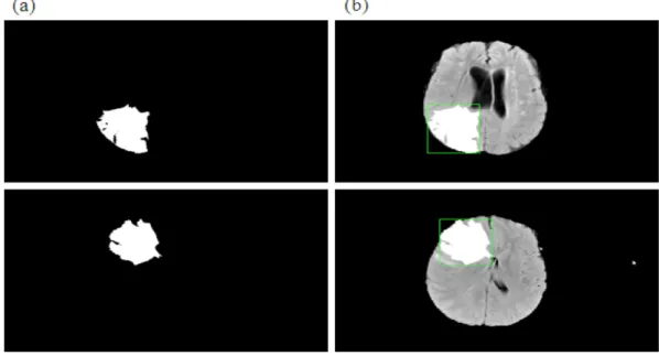 Fig. 9. Brain MRI outputs (a) Binary images, (b) Tumor segmentation images.