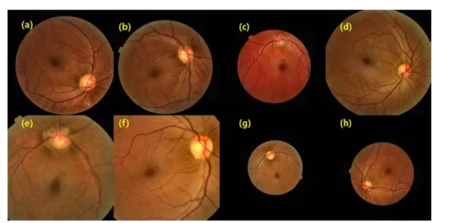 Fig. 4. Typical examples of augmented validation images. (a)-(h): 8 example images of augmented validation data.
