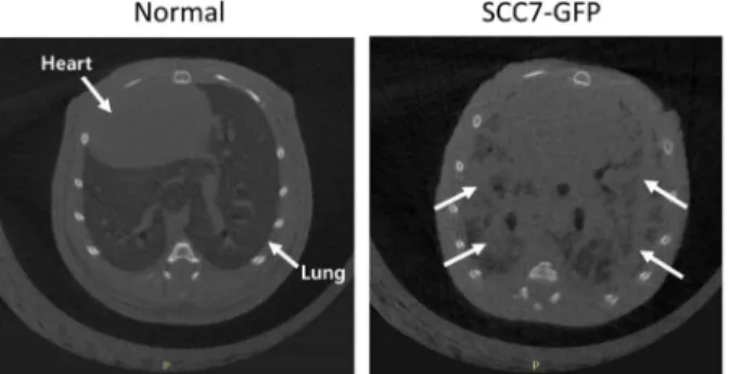 Fig. 3. Normal lung and lung metastasis image by micro-CT.