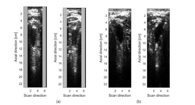 Fig. 8. Ultrasound images of a human bladder. (a) Two images acquired by hand-motion scan