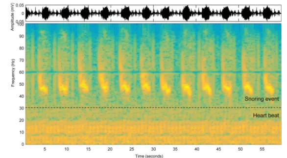 Fig. 2. The time frequency analysis of the piezoelectric sensor signal. Piezoelectric sensor signal(top), Spectrogram(bottom).