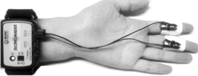 Fig. 1. Attachment of electrodes and a wireless transmitter module for measuring electrodermal activity on the fingers.