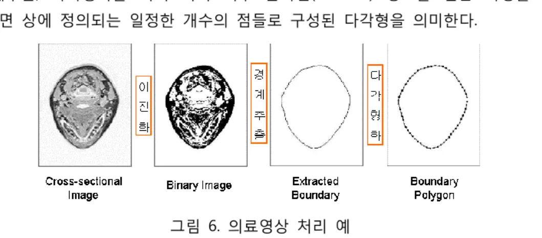 그림  6은  전형적인  의료영상  처리  예를  나타낸다.  인체  머리  부위에  대한  MRI  영상으로부터  이진화,  경계추출,  다각형화를  거쳐  머리  외부  윤곽선(contour)  정보를  얻는  과정을  보여준다