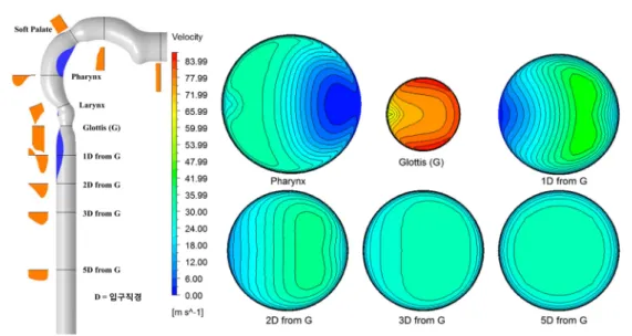 Fig. 4. Velocity distribution and recirculation zone when the inspiratory flow rate is 254 L/min