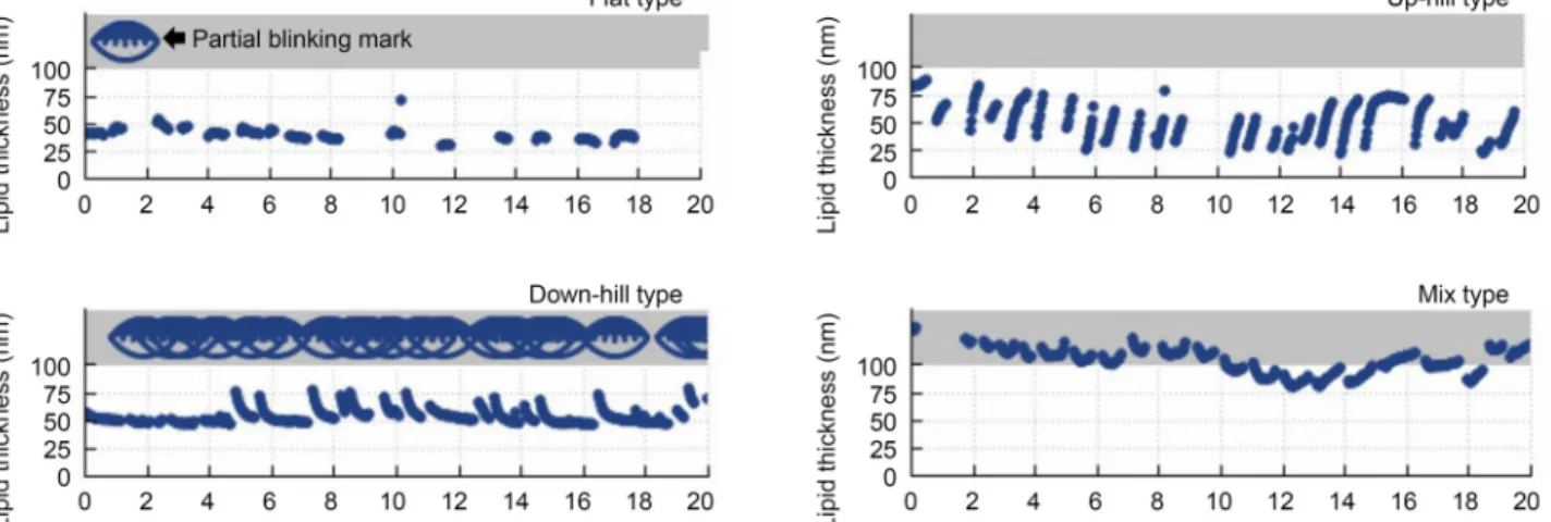 Figure 1. Examples of graphs which tear film lipid layer thickness measured by Lipiview® (TearScience Inc., Morrisville, NC,  USA)