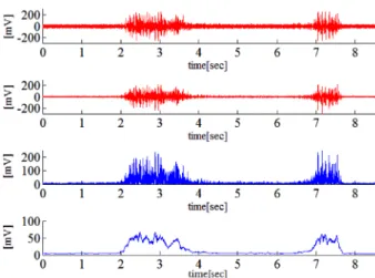 Fig. 6. Results of EMG signal processing measured on femoris muscle when standing (a) input EMG, (b) 60 Hz noise rejection, (c) full rectification, (d) output envelope