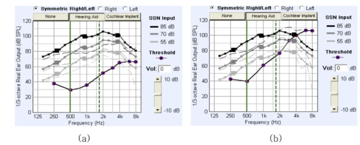 Fig. 5. The output level of the hearing aid applying NAL-NL1 insertion gain (a) mild gently sloping hearing loss, (b) moderate to steeply sloping hearing loss