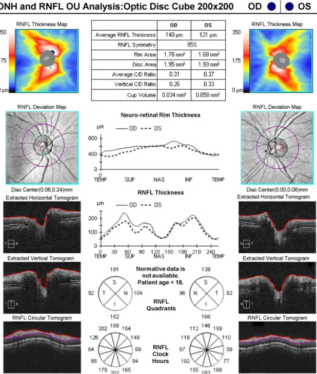Figure 2. Spectral-domain optical coherence tomograph of the patient at the initial visit