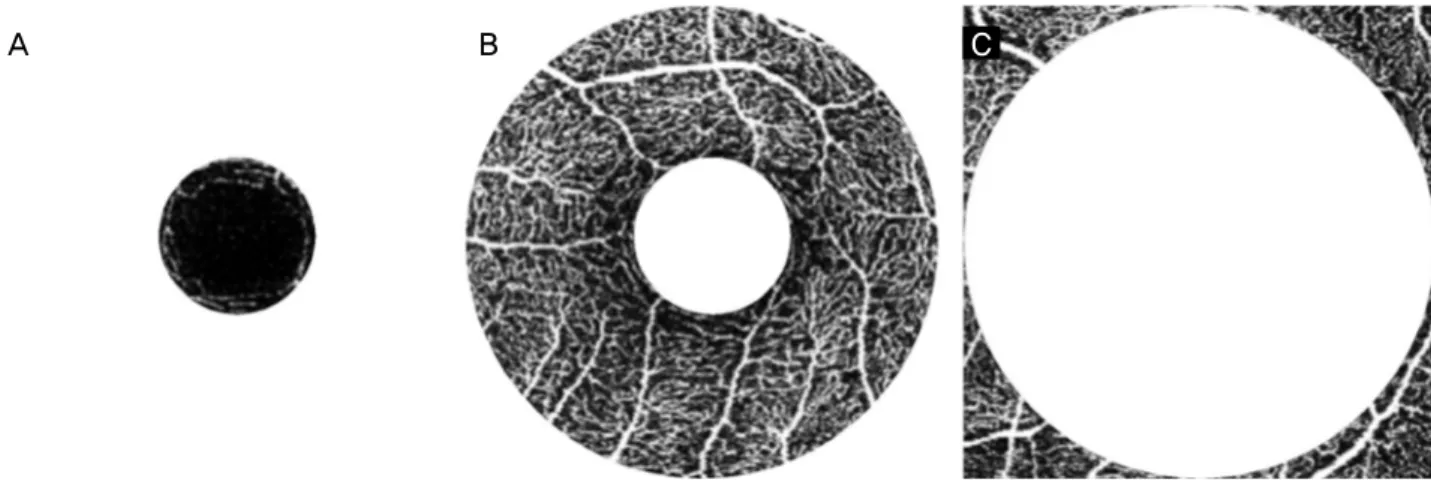 Figure 2. Zones divided by distance from the fovea. (A) Fovea centered 1 mm circle area (zone A)