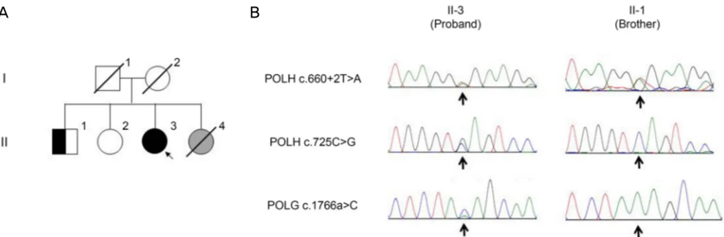 Figure 4. Pedigree of the xeroderma pigmentosum (XP)-affected family and POLH gene mutation analysis for the proband (II-3) and  proband's brother (II-1)