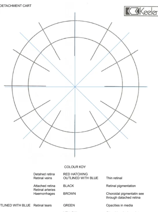 Figure 1. Detachment chart. Outer circle represents ora serrata and inner circle represents equator of the globe