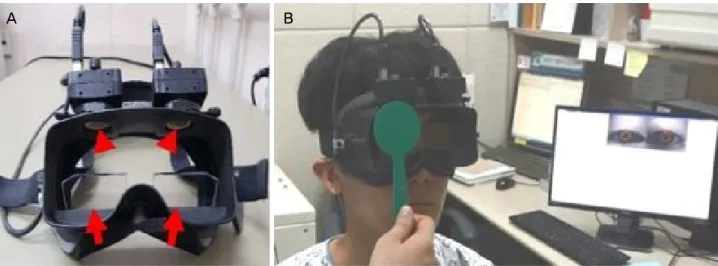 Figure 1. A video-oculography (VOG) (accuracy: 0.1 degree). (A) Two cameras installed at the top can make measurements of both  eye movements (red arrowheads)