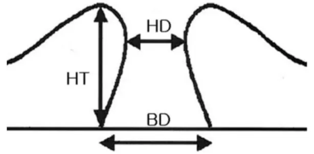 Figure 1. Parameter of macular hole on optical coherence  tomography. The macular hole diameters measured at the level of  retinal pigment epithelium (BD), at the minimum extent of the  hole (HD)