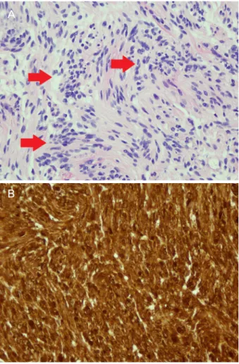Figure 2. Light micrograph of excisional biopsy specimen. 