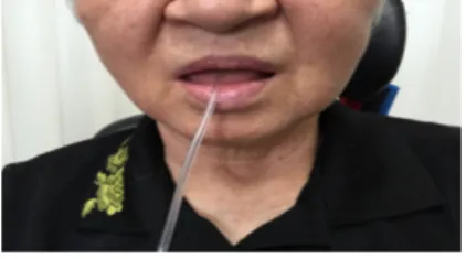 표 1. 혀 저항정확도훈련 및 구강안면운동 프로그램