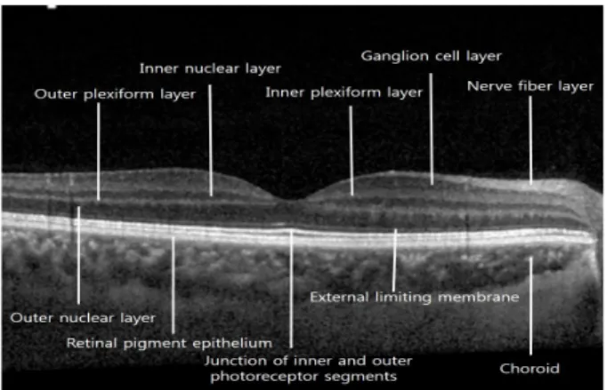 Figure 1. Optical coherence tomography image of right eye. 