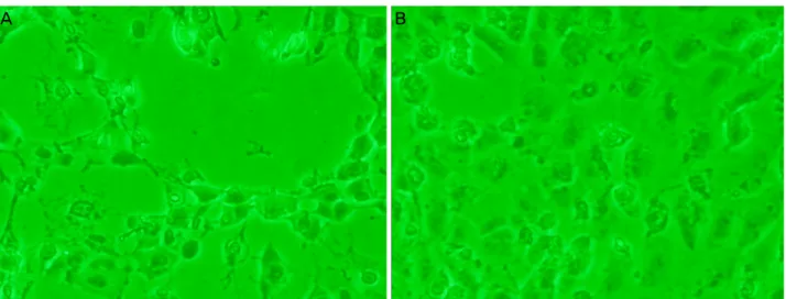Figure 4. Morphology of ARPE-19 cells exposed to H 2 O 2  (400 μM) with/without grape seed-derived polyphenols (GSP)