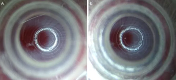 Figure 1. The method to measure corneal wetting property. (A) The images of microscopic light and corneal disk rings on the cornea  are clear
