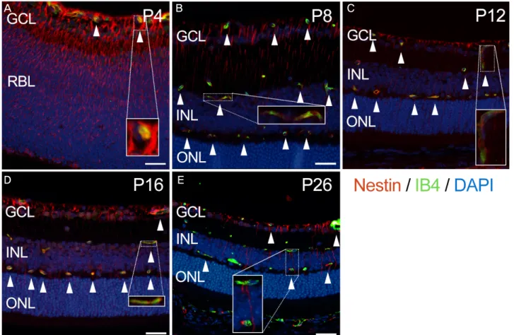 Figure 2. The nestin expression merged with the expression of IB4 in developing mouse retina