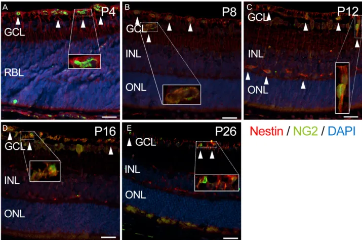 Figure 3. The nestin expression merged with the expression of NG2 in developing mouse retina