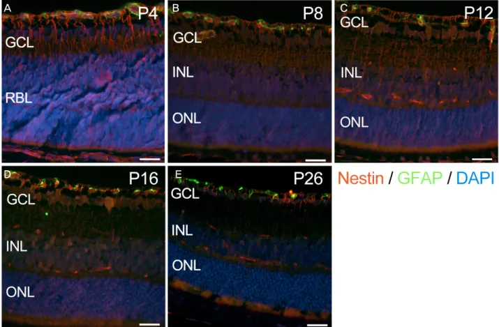 Figure 4. The nestin expression (red) merged with the expression of GFAP (green) in developing mouse retina