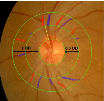 Figure 1. Fundus photograph centered at the optic disc of left  eye, grader analysis measures arteries and veins, the largest  six arteries (red) and veins (blue) are used to calculate the  cen-tral retinal artery equivalent and cencen-tral retinal vein eq