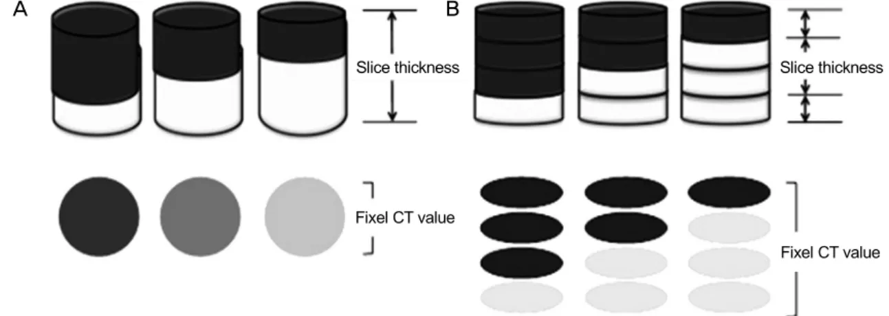 Figure 4. Diagram of partial volume effect. (A) Pixel computed tomography (CT) value with thick slice